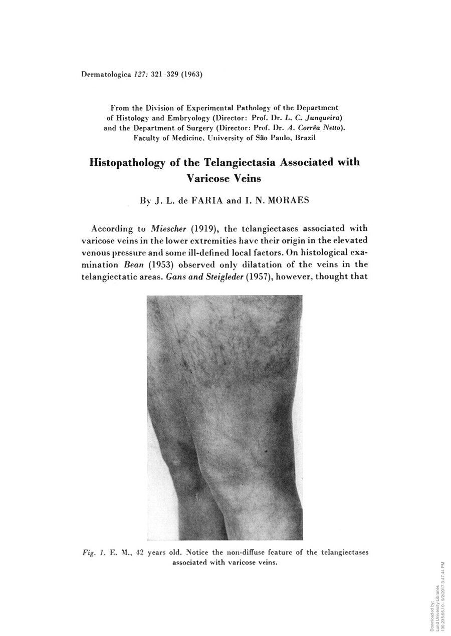 Primeira página do artigo Histopathology of the Telangiectasia Associated with Varicose Veins, publicado na revista Dermatologica